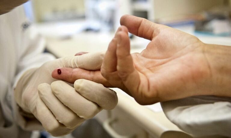 HIV-1024x613