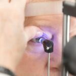 glaucoma