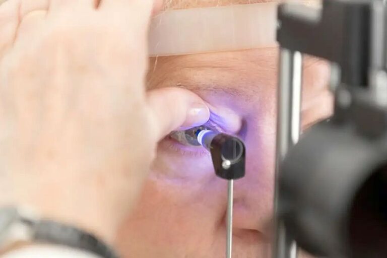 glaucoma